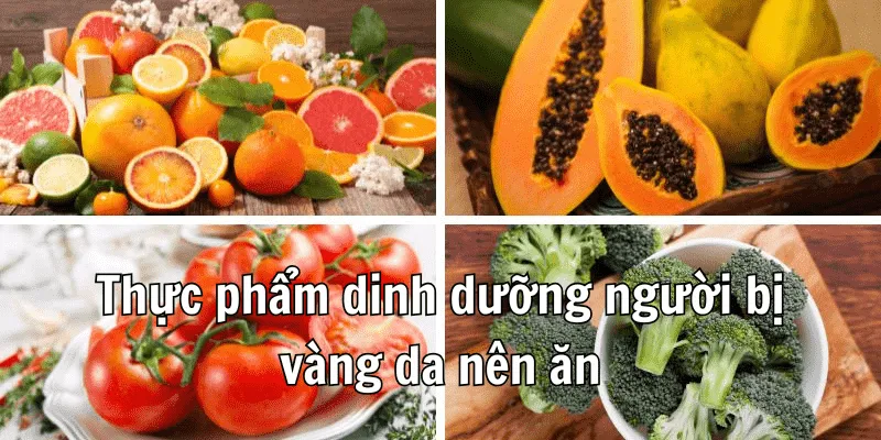 Người Bị Vàng Da Nên Ăn Gì Là Phù Hợp Nhất