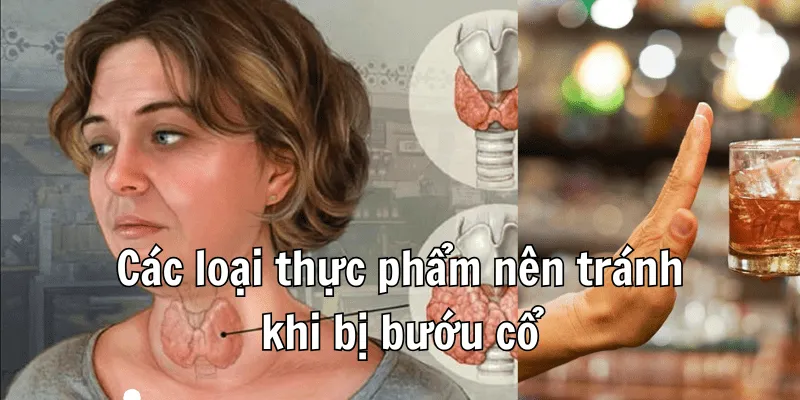 Bệnh Bướu Cổ Nên Kiêng Ăn Gì Để Hồi Phục Sức Khoẻ 1 Bệnh Bướu Cổ Nên Kiêng Ăn Gì Để Hồi Phục Sức Khoẻ