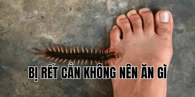 Bị Rết Cắn Không Nên Ăn Gì Và Cách Sơ Cứu Khi Bị Rết Cắn 23 1 min 30