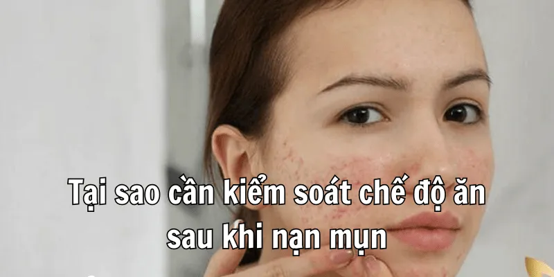 Mới Nặn Mụn Không Nên Ăn Gì Để Tránh Biến Chứng