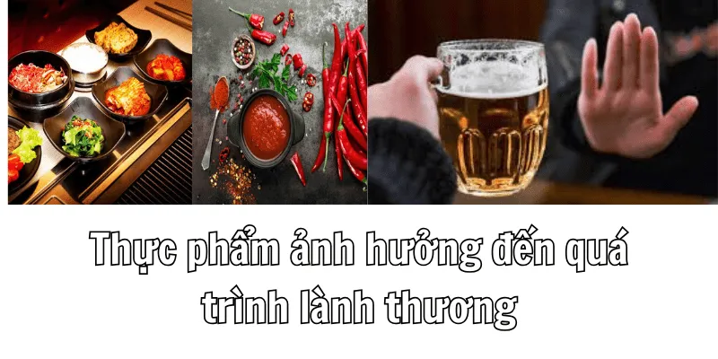 Bấm Lỗ Tai Không Nên Ăn Gì Để Vết Thương Nhanh Lành 2 2 2 min 6