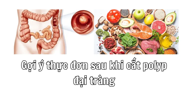 Sau Khi Cắt Polyp Đại Tràng Nên Ăn Gì Để Có Dưỡng Chất? 3 2 3 min 1