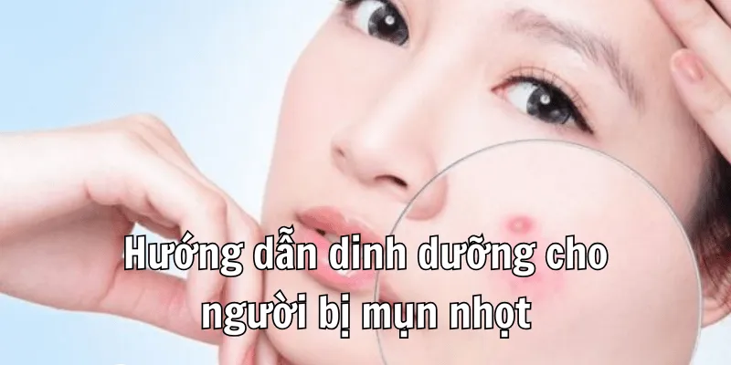 Bị Mụn Nhọt Không Nên Ăn Gì Cho Làn Da Sạch Mịn 3 2 3 min 8