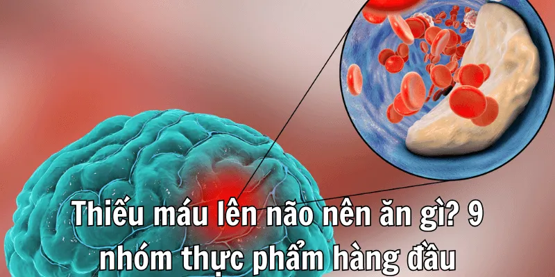 Thiếu máu lên não nên ăn gì để phục hồi bệnh nhanh nhất Thiếu máu lên não nên ăn gì để phục hồi bệnh nhanh nhất