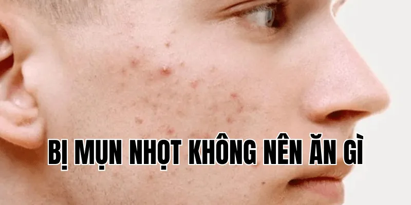 Viêm Da Cơ Địa Nên Ăn Gì Để Hỗ Trợ Điều Trị Hiệu Quả
