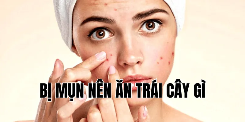 Viêm Da Cơ Địa Nên Ăn Gì Để Hỗ Trợ Điều Trị Hiệu Quả