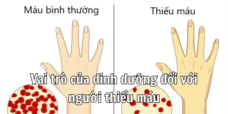 Thiếu Máu Nên Ăn Gì Để Bổ Sung Dưỡng Chất Cần Thiết?