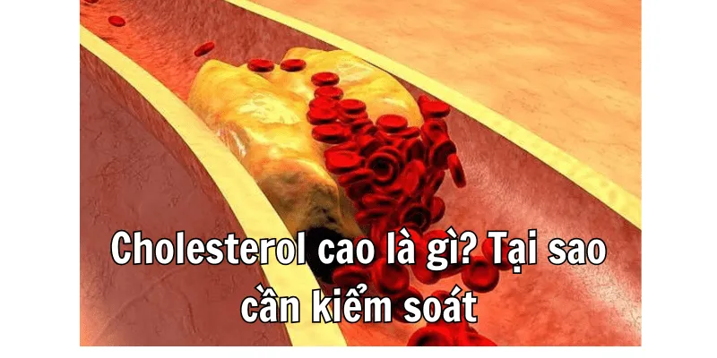 Bị Cholesterol Cao Không Nên Ăn Gì Để Bảo Vệ Sức Khỏe