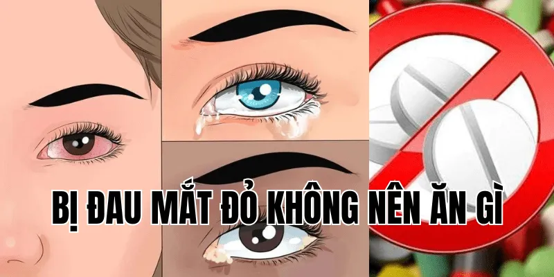 Bị Đau Mắt Đỏ Không Nên Ăn Gì Để Nhanh hồi Phục 25 3 min 29