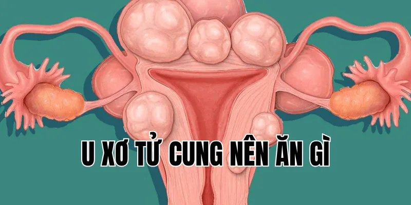 U Xơ Tử Cung Nên Ăn Gì - Chế Độ Dinh Dưỡng Hiệu Quả Nhất 5 3 min 37