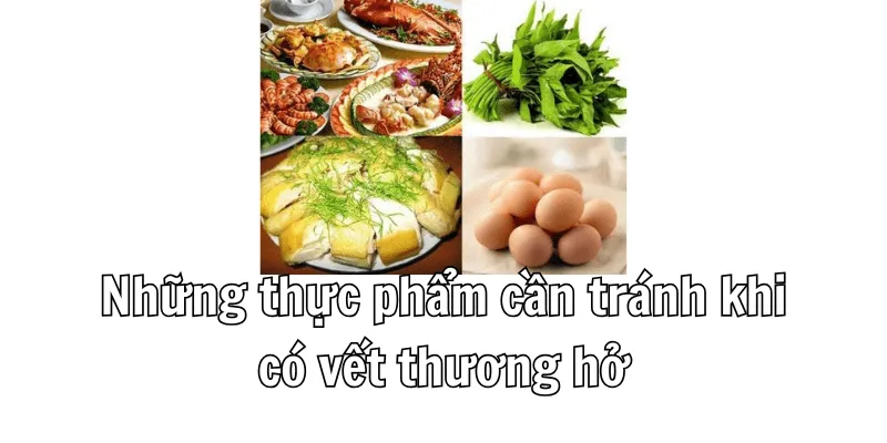 Vết Thương Hở Không Nên Ăn Gì Để Nhanh Lành Nhất 1 4 1 min 4