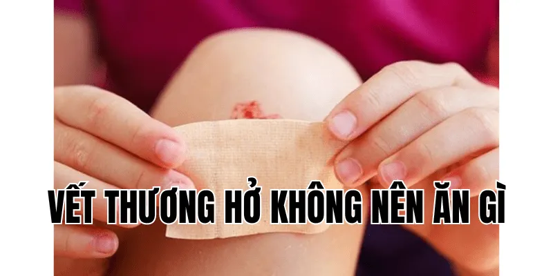 Vết Thương Hở Không Nên Ăn Gì Để Nhanh Lành Nhất 3 4 min 4