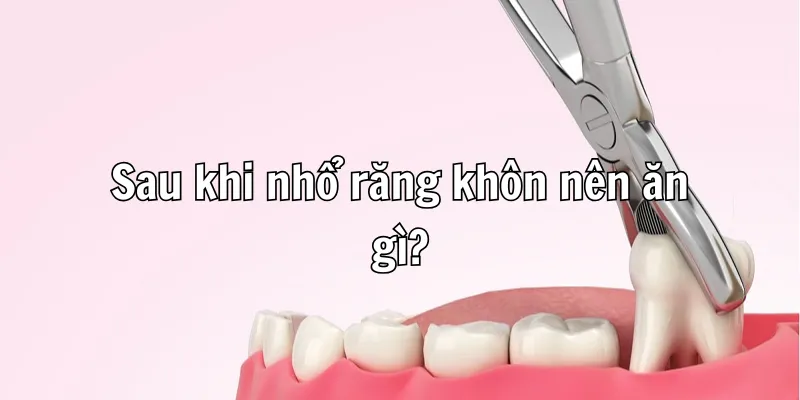 Sau khi nhổ răng khôn nên ăn gì